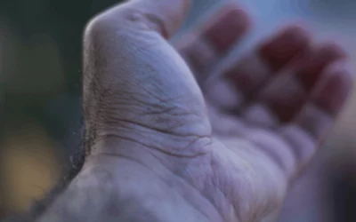 Carpal Tunnel