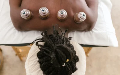 The Benefits of Cupping in Physical Therapy: A Holistic Approach to Healin